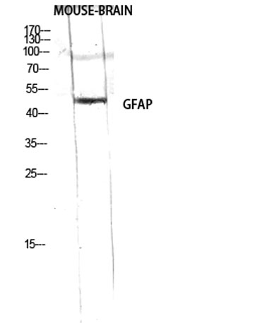 Western Blot analysis of RAW using GFAP Polyclonal Antibody diluted at 1:2000