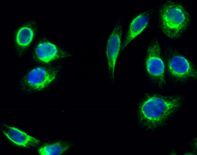 Immunofluorescence analysis of Hela cell. 1,Tsg 101 Polyclonal Antibody(green) was diluted at 1:200(4° overnight). 2, Goat Anti Rabbit Alexa Fluor 488 was diluted at 1:1000(room temperature, 50min). 3 DAPI(blue) 10min.