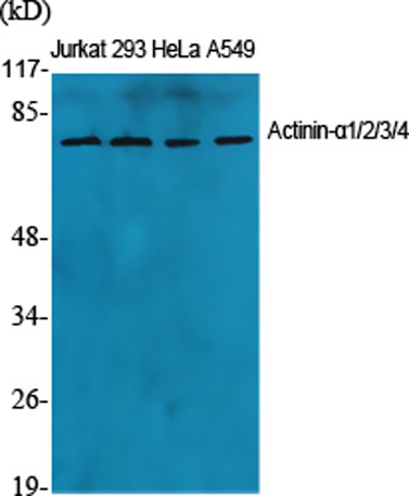 Western Blot analysis of various cells using Actinin-α1/2/3/4 Polyclonal Antibody diluted at 1:1000