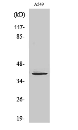 Western Blot analysis of various cells using Myogenin Polyclonal Antibody cells nucleus extracted by Minute TM Cytoplasmic and Nuclear Fractionation kit (SC-003,Inventbiotech,MN,USA).