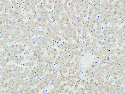 Immunohistochemical analysis of paraffin-embedded Human liver. 1, Antibody was diluted at 1:100(4° overnight). 2, High-pressure and temperature EDTA, pH8.0 was used for antigen retrieval. 3,Secondary antibody was diluted at 1:200(room temperature, 30min)