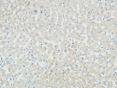 Immunohistochemical analysis of paraffin-embedded Human liver. 1, Antibody was diluted at 1:100(4° overnight). 2, High-pressure and temperature EDTA, pH8.0 was used for antigen retrieval. 3,Secondary antibody was diluted at 1:200(room temperature, 30min)