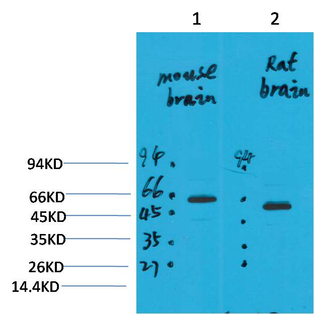 Western blot analysis of 1) Mouse Brain Tissue, 2)Rat Brain Tissue with EAAT2 Rabbit pAb diluted at 1:2,000.