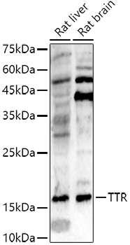 Western blot analysis of various lysates using TTR Rabbit Polyclonal Antibody at 1:500 dilution. Secondary antibody: HRP-conjugated Goat anti-Rabbit IgG (H+L) at 1:10000 dilution. Lysates/proteins: 25 μg per lane. Blocking buffer: 3% nonfat dry milk in TBST. Detection: ECL Enhanced Kit. Exposure time: 180s.