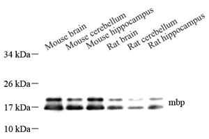 WB analysis of Myelin Basic Protein . Sample: Protein treated by RIPA Lysis Buffer . Blocking buffer: 3% Nonfat dry milk in TBST, RT, 1h. Primary antibody: 1: 1000, 4℃ overnight. Secondary antibody: HRP Goat Anti-Rabbit lgG , 1: 3000, RT, 1h.