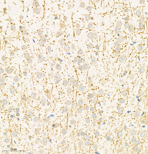IHC analysis of MBP . Sample: Rat striatum , 4% PFA 12-24h. Antigen retrieval: Citrate buffer ,98℃,20 min. Blocking buffer: 3% BSA in PBS , RT, 30min. Primary antibody: 1: 600, 4℃ overnight. Secondary antibody: HRP Goat Anti-Rabbit lgG , 1: 200 RT 1h.
