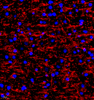 IF analysis of MBP . Sample: Rat brain , 4% PFA 12-24h. Antigen retrieval: Citrate buffer ,98℃,20 min. Blocking buffer: 3% BSA in PBS , RT, 30min. Primary antibody: 1: 300, 4℃ overnight. Secondary antibody: Cy3 conjugated Goat Anti-Rabbit IgG , 1: 300 RT, 1h.