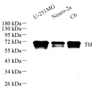 WB analysis of Tyrosine Hydroxylase . Sample: Protein treated by RIPA Lysis Buffer . Blocking buffer: 3% Nonfat dry milk in TBST, RT, 1h. Primary antibody: 1: 1000, 4℃ overnight. Secondary antibody: HRP Goat Anti-Rabbit lgG , 1: 3000, RT, 1h.