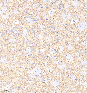 IHC analysis of Tyrosine Hydroxylase . Sample: Mouse corpus striatum , 4% PFA 12-24h. Antigen retrieval: Citrate buffer ,98℃,20 min. Blocking buffer: 3% BSA in PBS , RT, 30min. Primary antibody: 1: 1000, 4℃ overnight. Secondary antibody: HRP Goat Anti-Rabbit lgG , 1: 200 RT 1h.