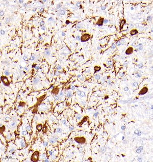 IHC analysis of Tyrosine Hydroxylase . Sample: Mouse substantia nigra , 4% PFA 12-24h. Antigen retrieval: Citrate buffer ,98℃,20 min. Blocking buffer: 3% BSA in PBS , RT, 30min. Primary antibody: 1: 1000, 4℃ overnight. Secondary antibody: HRP Goat Anti-Rabbit lgG , 1: 200 RT 1h.