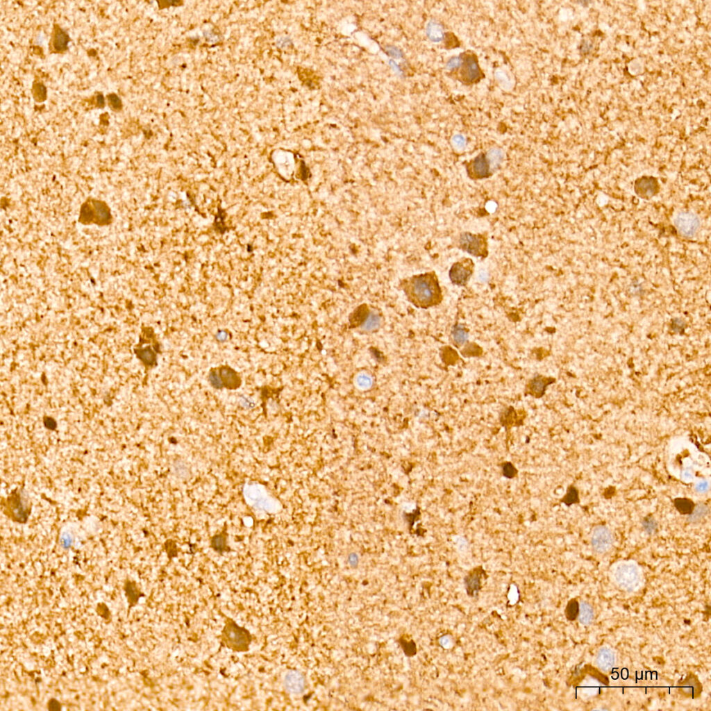 Immunohistochemistry analysis of paraffin-embedded Human brain tissue using S100B Rabbit mAb at a dilution of 1:10000 (40x lens). High pressure antigen retrieval performed with 0.01M Tris-EDTA Buffer (pH 9.0) prior to IHC staining.