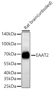 Western blot analysis of lysates from Rat brain using EAAT2 Rabbit mAb at 1:8000 dilution incubated overnight at 4℃. Secondary antibody: HRP-conjugated Goat anti-Rabbit IgG (H+L) at 1:10000 dilution. Lysates/proteins: 25 μg per lane. Blocking buffer: 3% nonfat dry milk in TBST. Detection: ECL Basic Kit Exposure time: 10s.