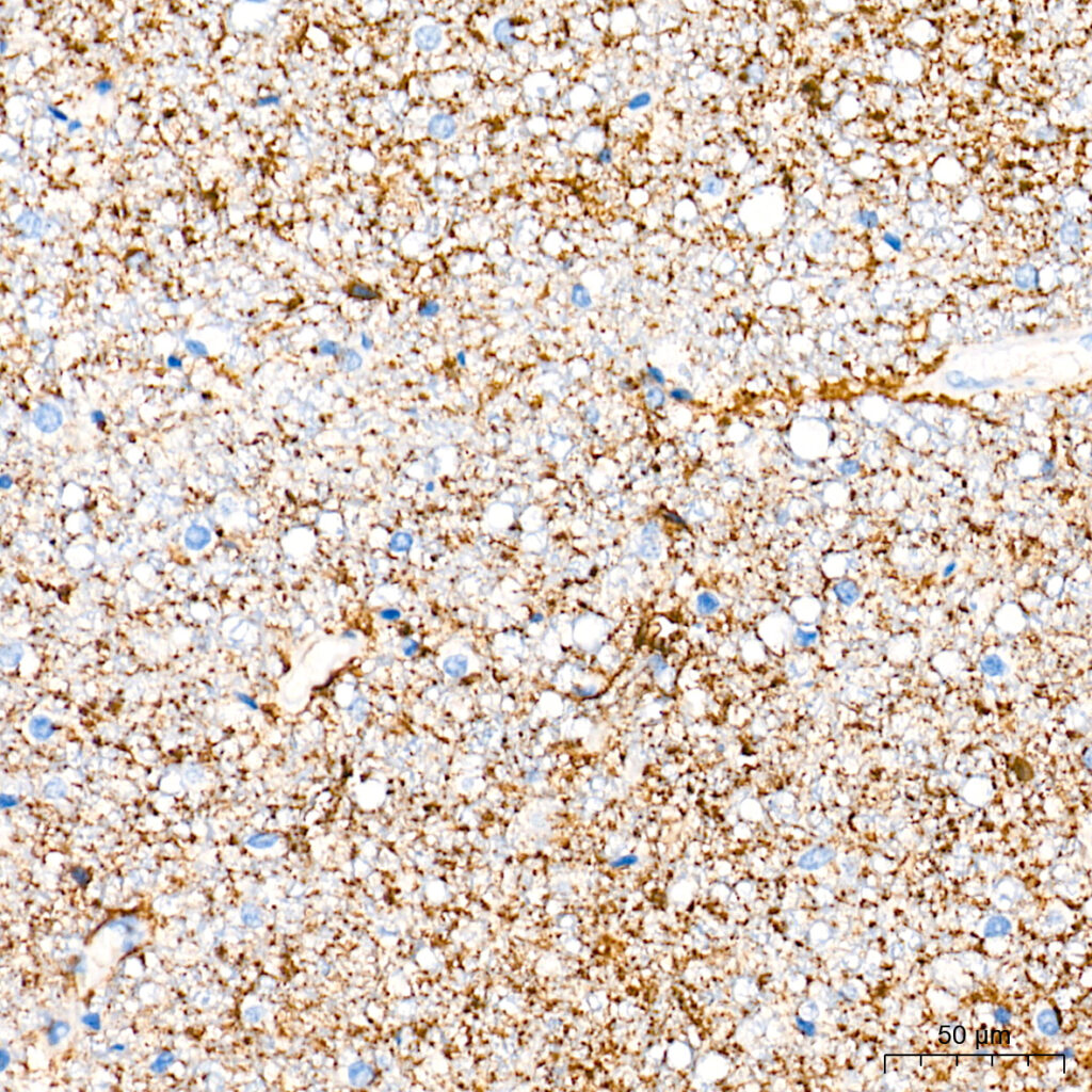 Immunohistochemistry analysis of paraffin-embedded Human brain tissue using EAAT2 Rabbit mAb at a dilution of 1:8000 (40x lens). High pressure antigen retrieval performed with 0.01M Tris-EDTA Buffer(pH 9.0) prior to IHC staining.