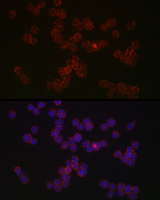 Immunofluorescence analysis of THP-1 cells using CCR5 Rabbit pAb at dilution of 1:50 (40x lens). Secondary antibody: Cy3-conjugated Goat anti-Rabbit IgG (H+L) at 1:500 dilution. Blue: DAPI for nuclear staining.