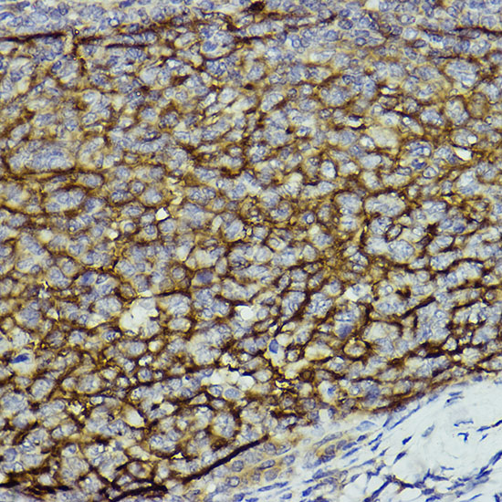 Immunohistochemistry analysis of paraffin-embedded Human tonsil using CD11b/ITGAM Rabbit pAb at dilution of 1:100 (40x lens). High pressure antigen retrieval performed with 0.01M Citrate buffer (pH 6.0) prior to IHC staining.
