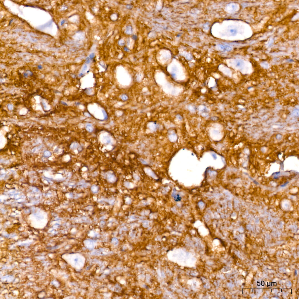 Immunohistochemistry analysis of paraffin-embedded Rat brain tissue using EAAT1/SLC1A3 Rabbit mAb at a dilution of 1:200 (40x lens). High pressure antigen retrieval performed with 0.01M Citrate buffer (pH 6.0) prior to IHC staining.