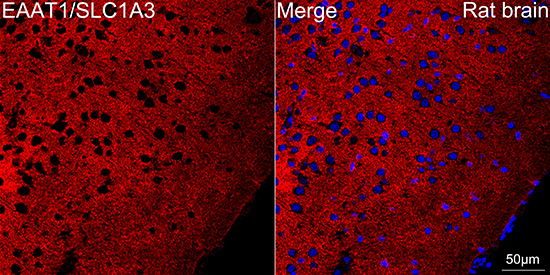Confocal imaging of paraffin-embedded Rat brain tissue using EAAT1/SLC1A3 Rabbit mAb (, dilution 1:200) followed by a further incubation with Cy3 Goat Anti-Rabbit IgG (H+L) ( dilution 1:500) (Red). DAPI was used for nuclear staining (Blue). Objective: 40x. Perform microwave antigen retrieval with 0.01 M citrate buffer (pH 6.0) prior to IF staining.