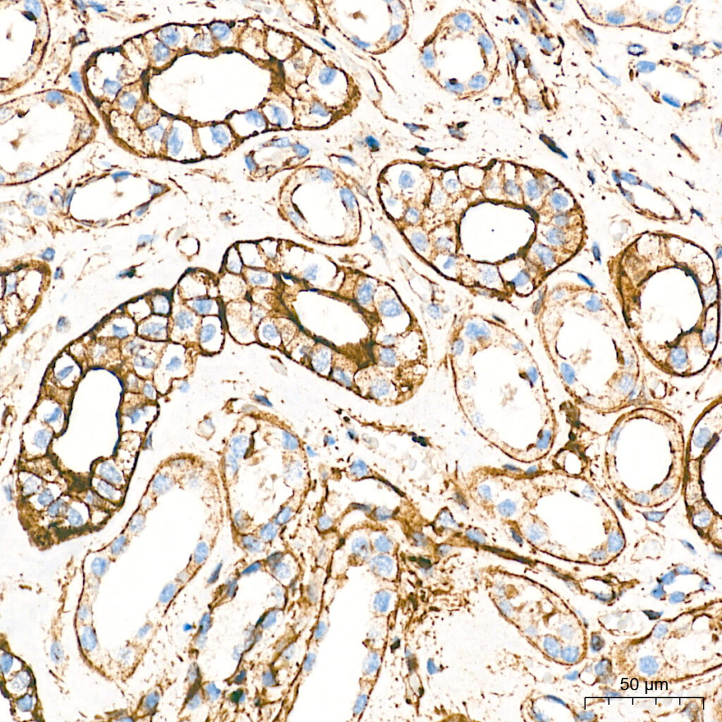 Immunohistochemistry analysis of paraffin-embedded Human kidney tissue using β-Actin Rabbit mAb at a dilution of 1:10000 (40x lens). High pressure antigen retrieval performed with 0.01M Tris-EDTA Buffer (pH 9.0) prior to IHC staining.