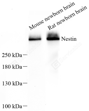 WB analysis of Nestin. Sample: Protein treated by RIPA Lysis Buffer . Blocking buffer: 3% Nonfat dry milk in TBST, RT, 1h. Primary antibody: 1: 500, 4℃ overnight. Secondary antibody: HRP conjugated Goat Anti-Mouse lgG , 1: 3000, RT, 1h.