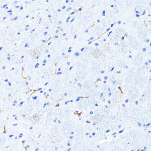 IHC analysis of Nestin. Sample: Mouse brain, 4% PFA 12-24h. Antigen retrieval: Tris-EDTA buffer , 98℃, 20min. Primary antibody: 1: 750, 4℃ overnight. Secondary antibody: S-vision poly-HRP conjugated Goat Anti-Mouse lgG , Ready to use, RT, 20min.