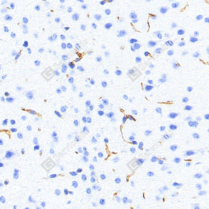 IHC analysis of Nestin. Sample: Mouse brain, 4% PFA 12-24h. Antigen retrieval: Tris-EDTA buffer , 98℃, 20min. Primary antibody: 1: 750, 4℃ overnight. Secondary antibody: S-vision poly-HRP conjugated Goat Anti-Mouse lgG , Ready to use, RT, 20min.