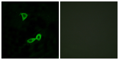 Immunofluorescence analysis of LOVO cells, using GRM2 Antibody. The picture on the right is blocked with the synthesized peptide.