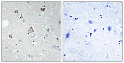 Immunohistochemistry analysis of paraffin-embedded human brain tissue, using GRM2 Antibody. The picture on the right is blocked with the synthesized peptide.