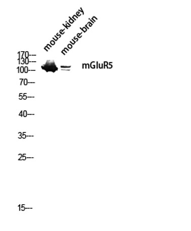 Western blot analysis of mouse-kidney mouse-brain lysis using mGluR5 antibody. Antibody was diluted at 1:1000
