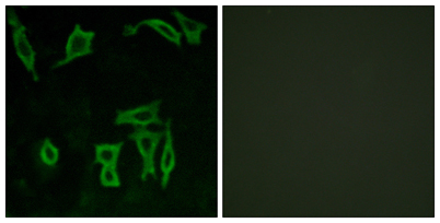 Immunofluorescence analysis of LOVO cells, using GRM5 Antibody. The picture on the right is blocked with the synthesized peptide.