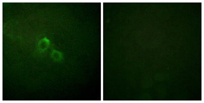 Immunofluorescence analysis of HUVEC cells, using Kv1.3/KCNA3 Antibody. The picture on the right is blocked with the synthesized peptide.