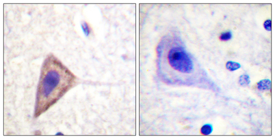 Immunohistochemistry analysis of paraffin-embedded human brain tissue, using Kv1.3/KCNA3 Antibody. The picture on the right is blocked with the synthesized peptide.