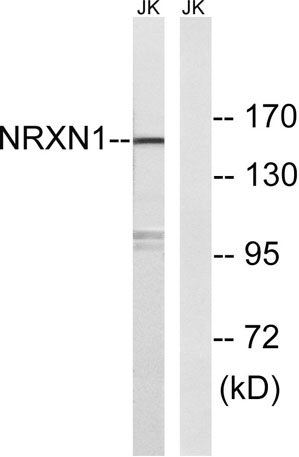 Western blot analysis of lysates from Jurkat cells, using NRXN1 Antibody. The lane on the right is blocked with the synthesized peptide.