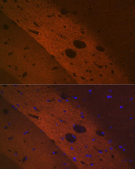 Immunofluorescence analysis of paraffin-embedded rat brain using mGluR2 Rabbit mAb at dilution of 1:100 (40x lens). Secondary antibody: Cy3-conjugated Goat anti-Rabbit IgG (H+L) at 1:500 dilution. Blue: DAPI for nuclear staining.