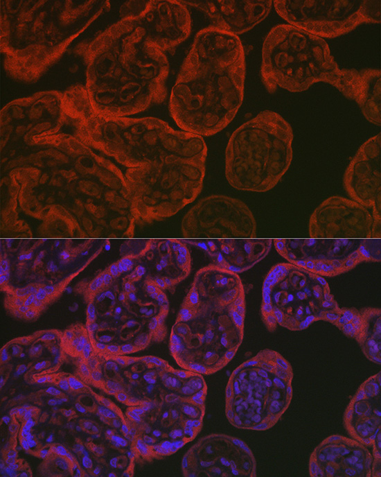 Immunofluorescence analysis of paraffin-embedded human placenta using eNOS Rabbit pAb at dilution of 1:50 (40x lens). Secondary antibody: Cy3-conjugated Goat anti-Rabbit IgG (H+L) at 1:500 dilution. Blue: DAPI for nuclear staining.