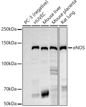 Western blot analysis of various lysates using eNOS Rabbit mAb at 1:1000 dilution. Secondary antibody: HRP-conjugated Goat anti-Rabbit IgG (H+L) at1:10000 dilution. Lysates/proteins: 25μg per lane. Blocking buffer: 3% nonfat dry milk in TBST. Detection: ECL West Pico Plus. Exposure time: 180s.