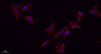 Immunofluorescence analysis of A549. 1,primary Antibody(red) was diluted at 1:200(4°C overnight). 2, Goat Anti Rabbit IgG (H&L) - Alexa Fluor 594 Secondary antibody was diluted at 1:1000(room temperature, 50min).3, Picture B: DAPI(blue) 10min.