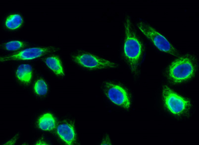 Immunofluorescence analysis of Hela cell. 1,NOS3 (phospho Ser1177) Polyclonal Antibody(green) was diluted at 1:200(4° overnight). 2, Goat Anti Rabbit Alexa Fluor 488 Catalogwas diluted at 1:1000(room temperature, 50min). 3 DAPI(blue) 10min.