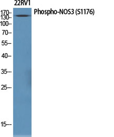 Western Blot analysis of various cells using Phospho-NOS3 (S1177) Polyclonal Antibody diluted at 1:1000