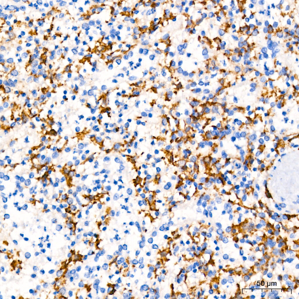 Immunohistochemistry analysis of paraffin-embedded Human spleen using TNF-α Rabbit pAb ) at dilution of 1:1000 (40x lens). High pressure antigen retrieval performed with 0.01M Citrate buffer (pH 6.0) prior to IHC staining.