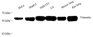 WB analysis of Vimentin . Sample: Protein treated by RIPA Lysis Buffer . Blocking buffer: 3% Nonfat dry milk in TBST, RT, 1h. Primary antibody: 1: 1000, 4℃ overnight. Secondary antibody: HRP Goat Anti-Rabbit lgG , 1: 3000, RT, 1h.