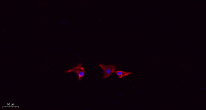 Immunofluorescence analysis of A549. 1,primary Antibody(red) was diluted at 1:200(4°C overnight). 2, Goat Anti Rabbit IgG (H&L) - Alexa Fluor 594 Secondary antibody was diluted at 1:1000(room temperature, 50min).3, Picture B: DAPI(blue) 10min.