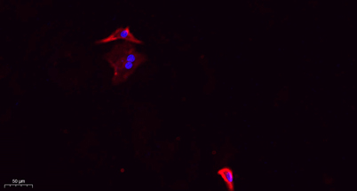 Immunofluorescence analysis of A549. 1,primary Antibody(red) was diluted at 1:200(4°C overnight). 2, Goat Anti Rabbit IgG (H&L) - Alexa Fluor 594 Secondary antibody was diluted at 1:1000(room temperature, 50min).3, Picture B: DAPI(blue) 10min.