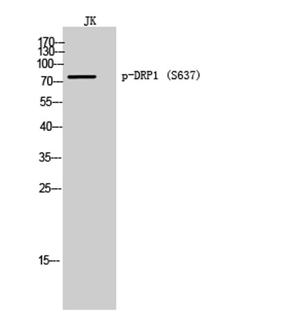 Western Blot analysis of JK cells using Phospho-DRP1 (S637) Polyclonal Antibody