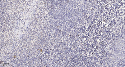 Immunohistochemical analysis of paraffin-embedded human tonsil. 1, Antibody was diluted at 1:200(4° overnight). 2, Tris-EDTA,pH9.0 was used for antigen retrieval. 3,Secondary antibody was diluted at 1:200(room temperature, 30min).