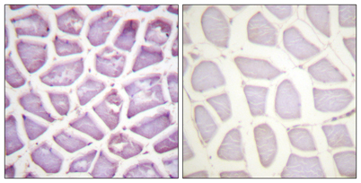 Immunohistochemistry analysis of paraffin-embedded human skeletal muscle, using Parkin (Phospho-Ser131) Antibody. The picture on the right is blocked with the phospho peptide.