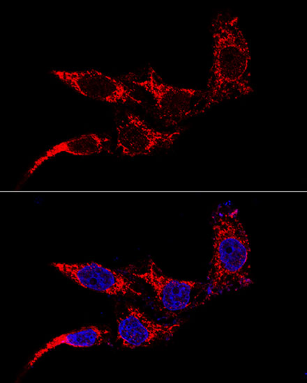 Confocal immunofluorescence analysis of HeLa cells using TTC11/FIS1 Rabbit pAb at dilution of 1:50 (60x lens). Blue: DAPI for nuclear staining.