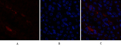 Immunofluorescence analysis of mouse-kidney tissue. 1,p21 Polyclonal Antibody(red) was diluted at 1:200(4°C,overnight). 2, Cy3 labled Secondary antibody was diluted at 1:300(room temperature, 50min). 3, Picture B: DAPI(blue) 10min. Picture A:Target. Pictur