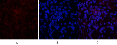 Immunofluorescence analysis of rat-lung tissue. 1,p21 Polyclonal Antibody(red) was diluted at 1:200(4°C,overnight). 2, Cy3 labled Secondary antibody was diluted at 1:300(room temperature, 50min). 3, Picture B: DAPI(blue) 10min. Picture A:Target. Picture B: