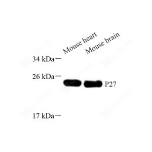 WB analysis of p27 KIP 1.Sample: Protein treated by RIPA Lysis Buffer .Blocking buffer: 3% Nonfat dry milk in TBST, RT, 1h.Primary antibody: 1: 1000, 4℃ overnight.Secondary antibody: HRP conjugated Goat Anti-Rabbit lgG , 1: 5000, RT, 1h.