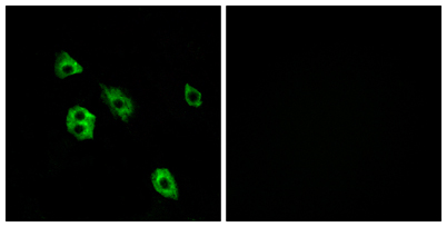 Immunofluorescence analysis of A549 cells, using GPR27 Antibody. The picture on the right is blocked with the synthesized peptide.